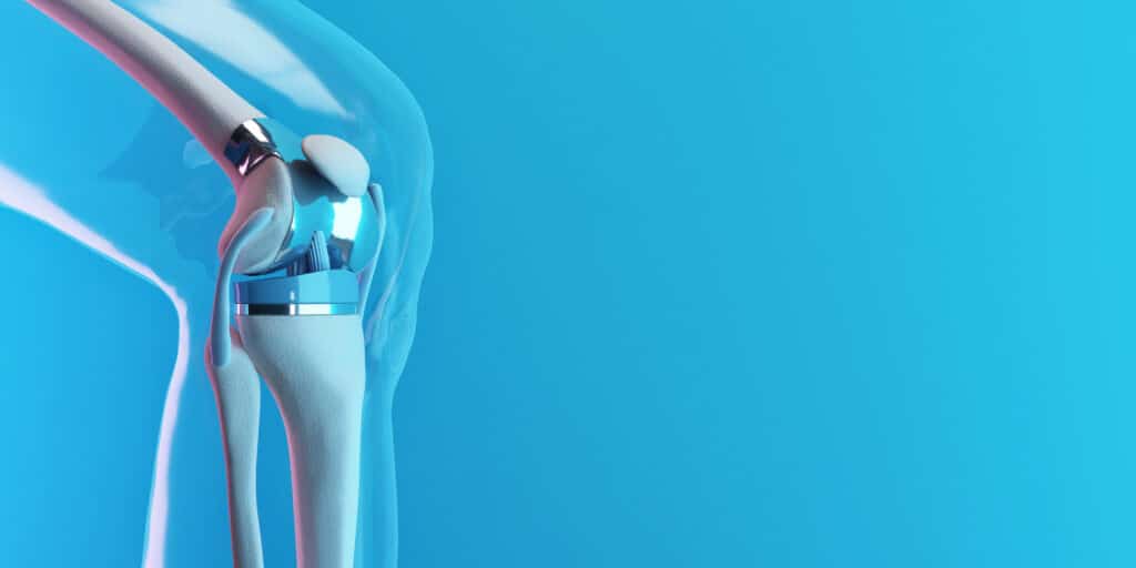 Technological advancements in orthopedic medicine have allowed patients to benefit from a variety of knee replacement procedures.