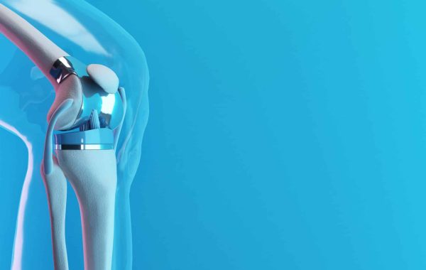 Technological advancements in orthopedic medicine have allowed patients to benefit from a variety of knee replacement procedures.